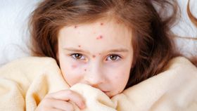 Alertă europeană de rujeolă! Organizația Mondială a Sănătății avertizează că vaccinarea împotriva bolii este vitală